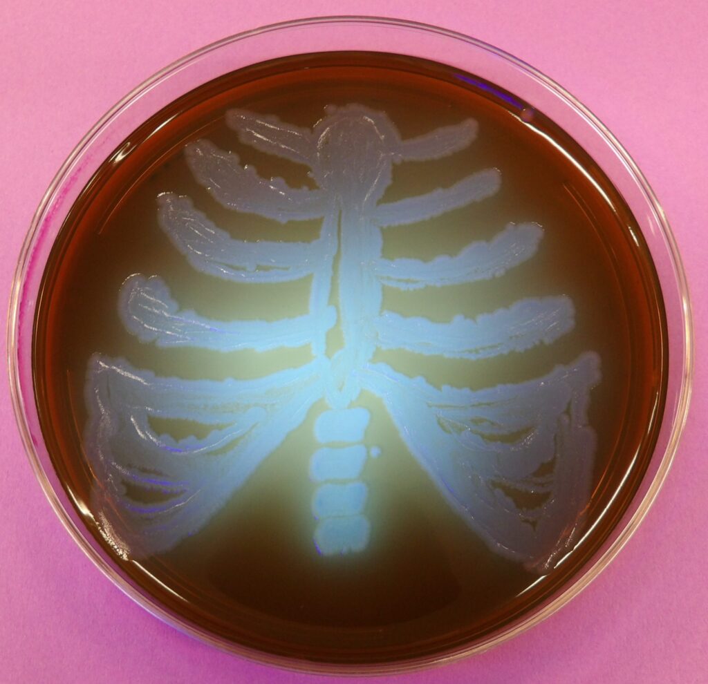Bacterial growth in a petri dish forms a ribcage and spine pattern on dark brown agar, against a pink background.