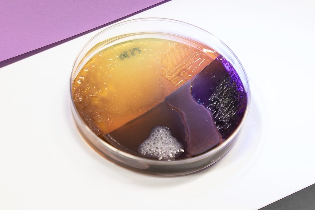 Petri dish split into four textured sections in yellow, orange, purple, and dark violet on a white and purple background.